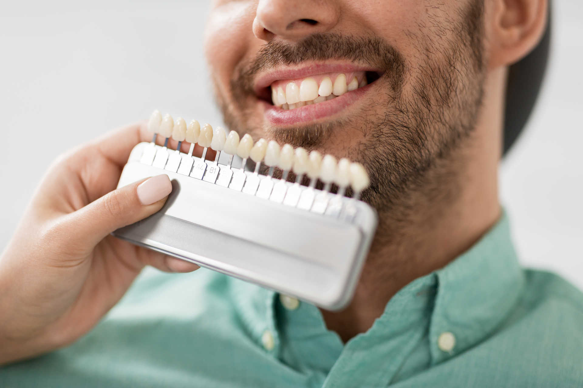 mann vorlage für veneers