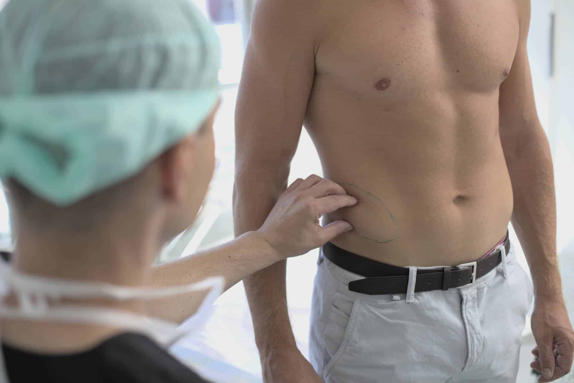 Kurz vor der Sixpack OP