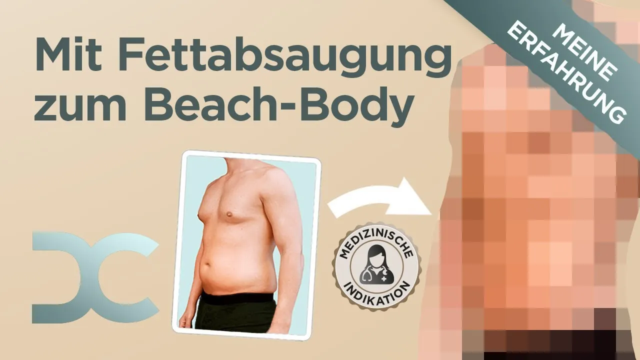 Body Sculpting: Methoden für eine straffe und definierte Figur