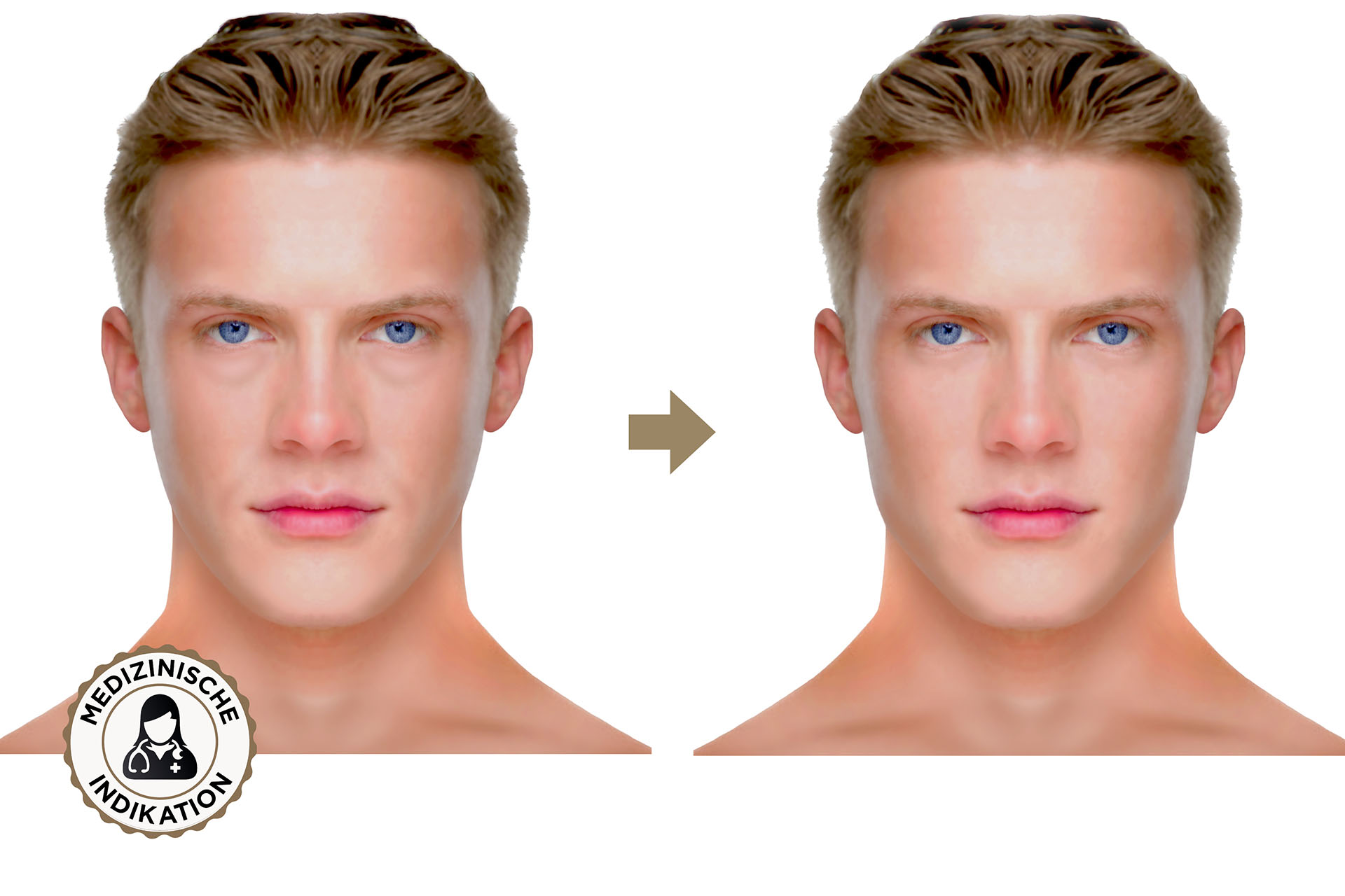Vorher-Nachher-Grafik Gesichtsbehandlung Mann