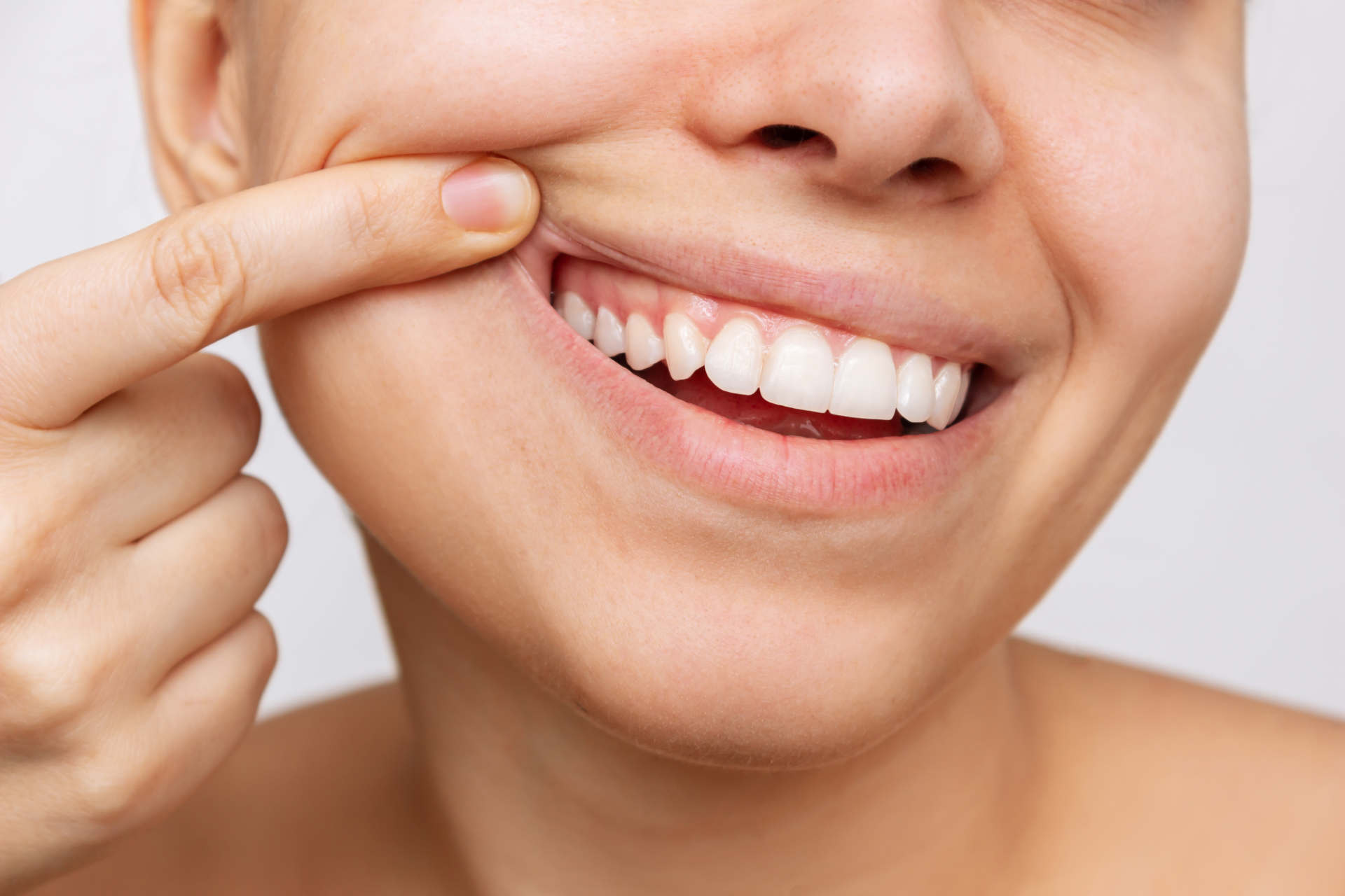 Frau zeigt gesundes Zahnfleisch