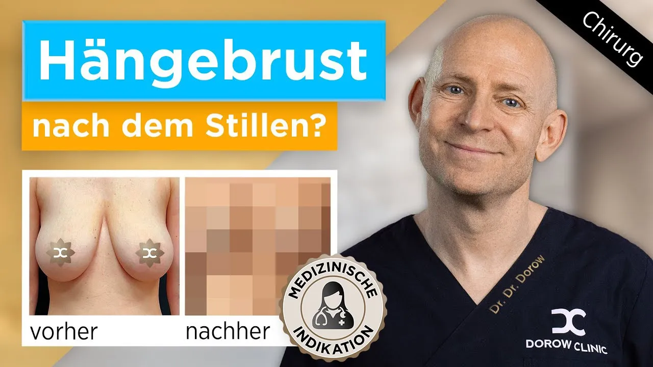 kleine schlaffe titten Schlaffe Brust nach Schwangerschaft und Stillzeit