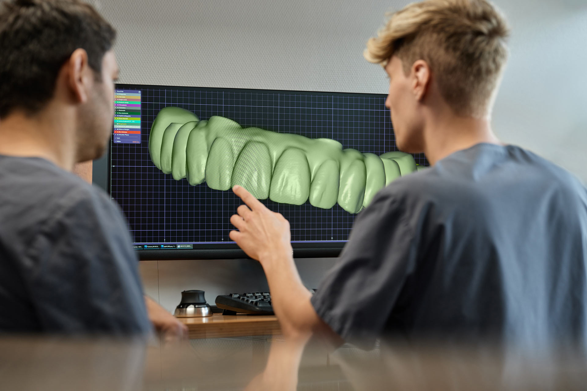 Zahntechniker besprechen das 3D Modell eines Patienten in der Dorow Clinic