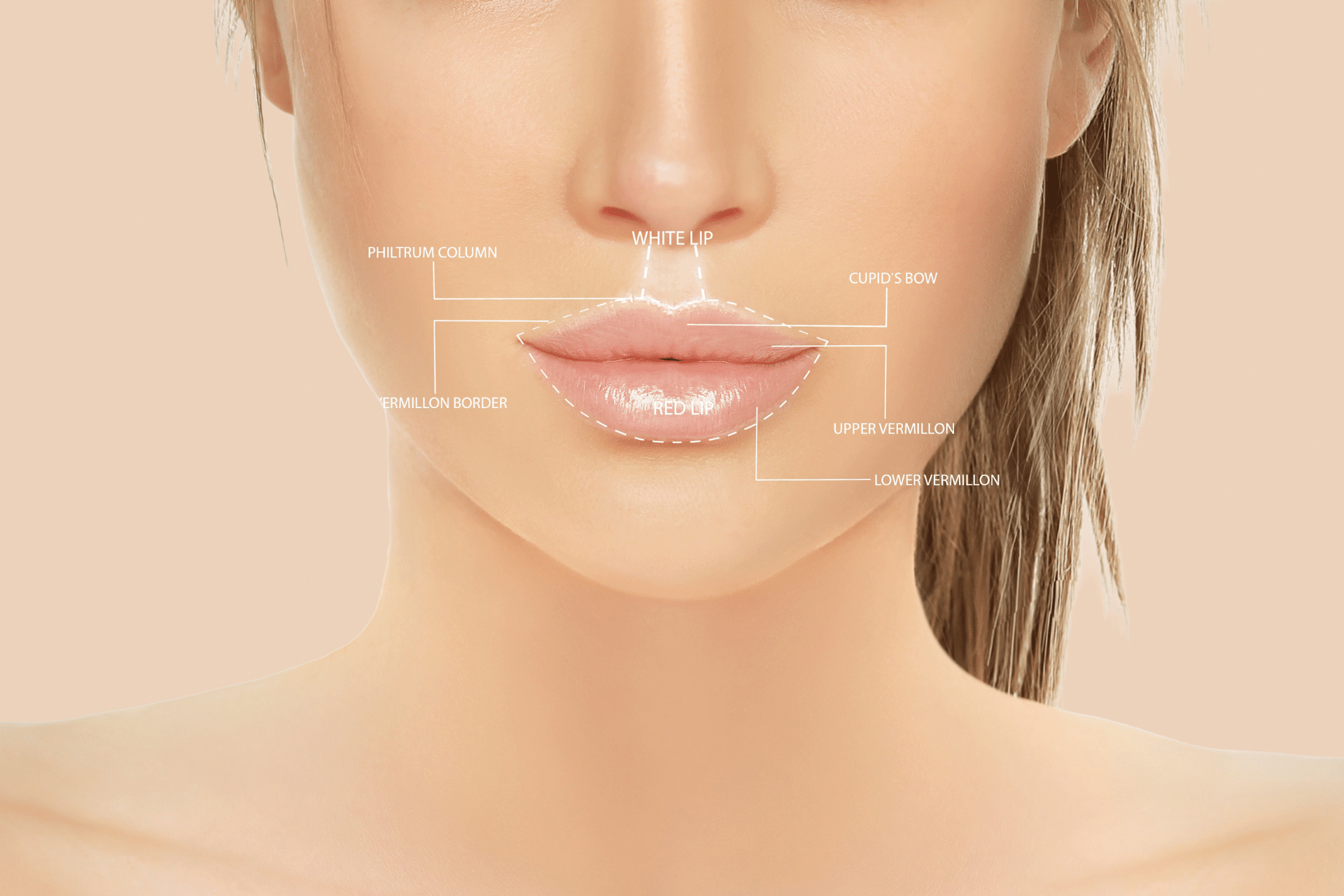 Bullhorn Lip Lift erklärt