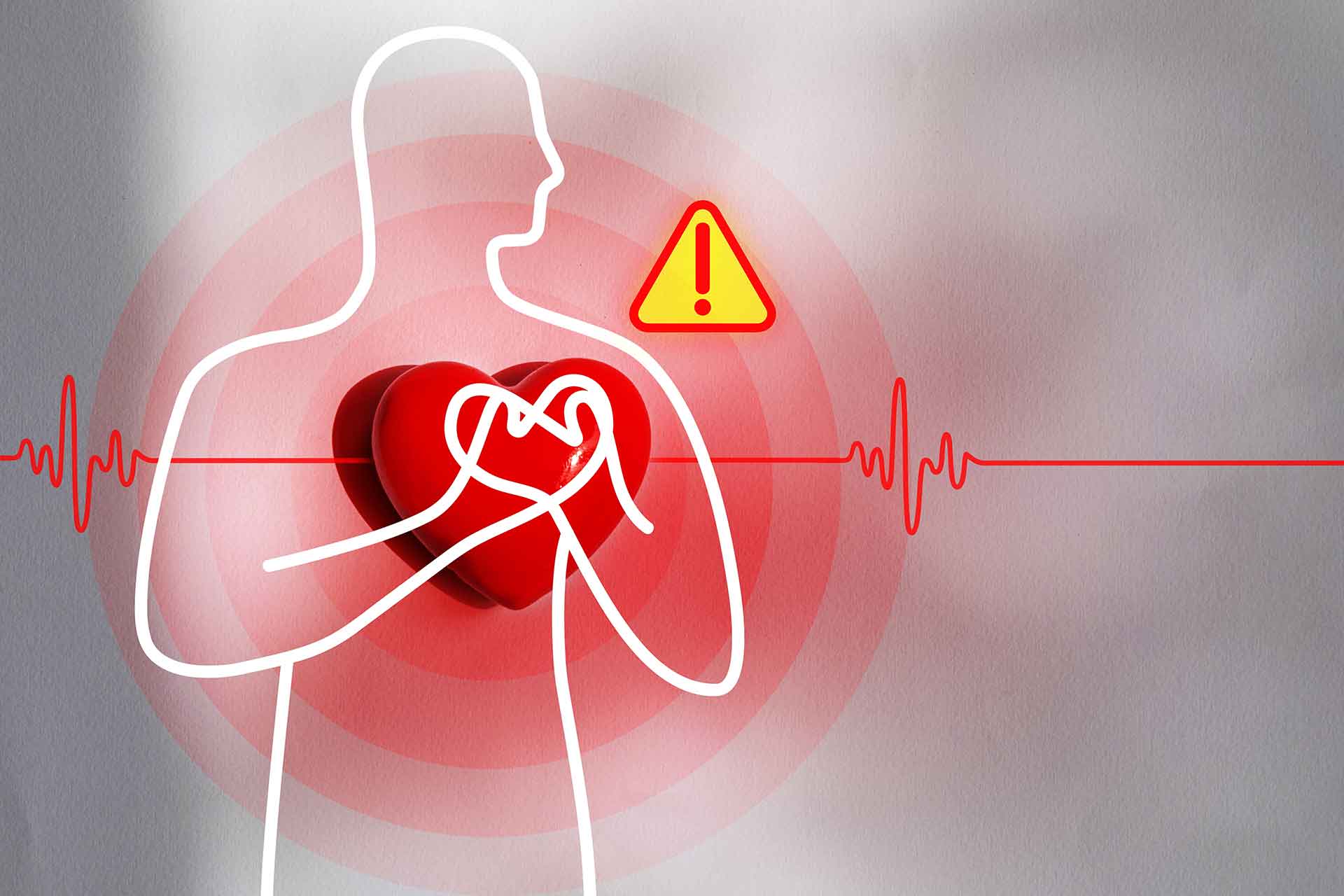 Parodontitis und Herz-Kreislauf-Erkrankungen