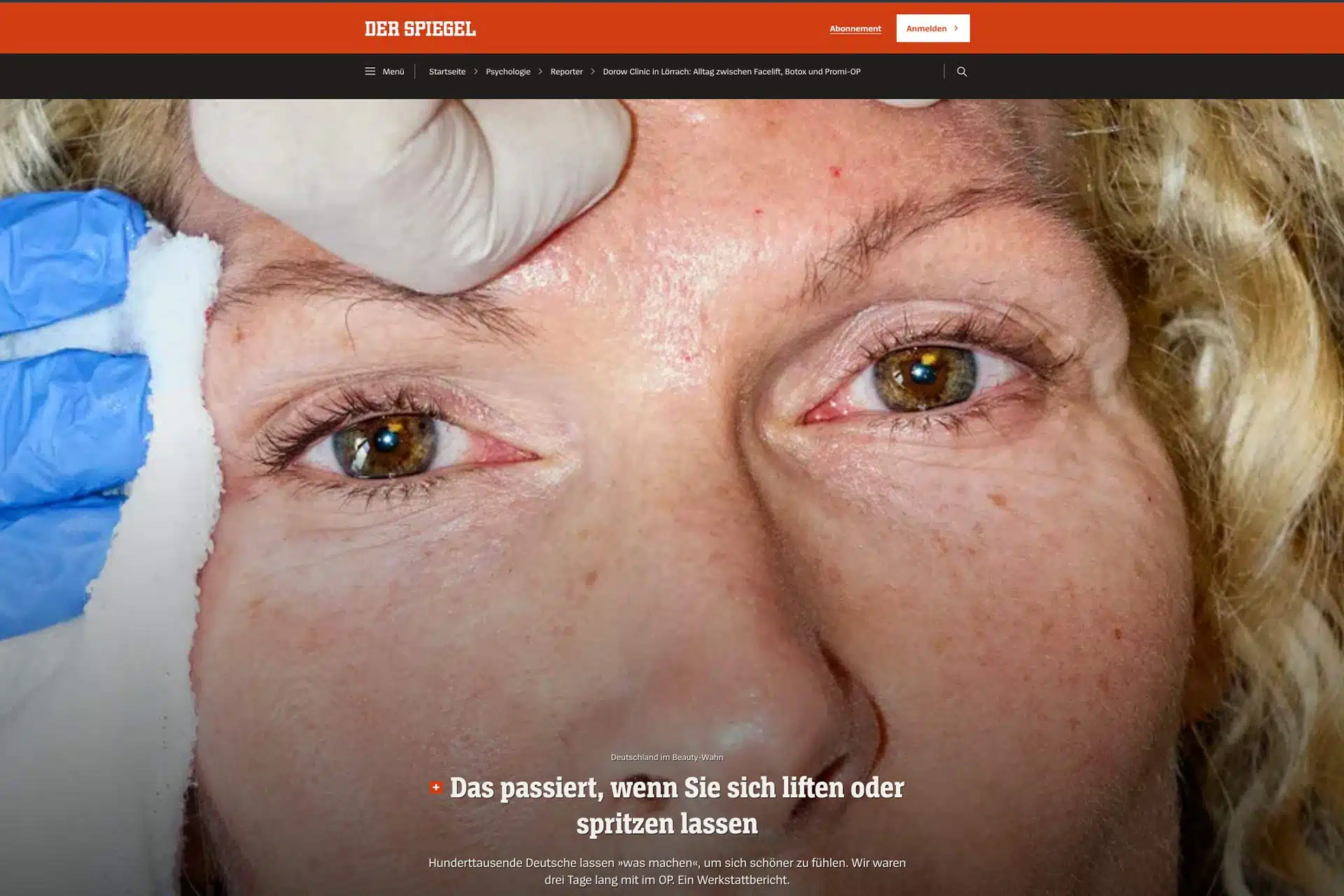 Beitrag zu ästhetischer Chirurgie bei der Spiegel im September 2026.